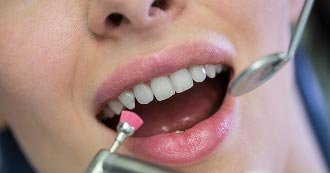 Preventive Dentistry