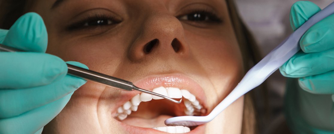 tooth-4
